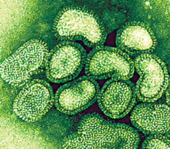 Swine Flu Up Close Swine Flu Up Close